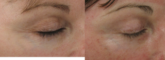 before and after image