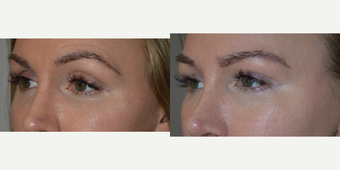 before and after image