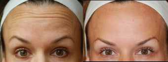before and after image