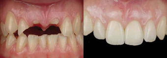 before and after image