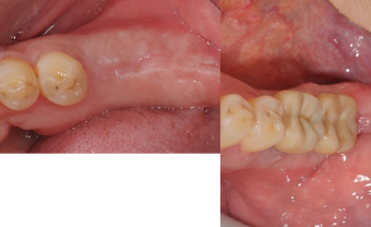 before and after image