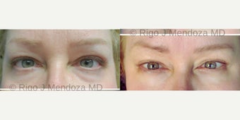 before and after image