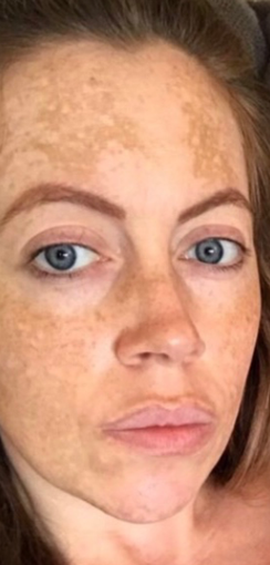 obagi nu derm system cost