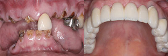 before and after image