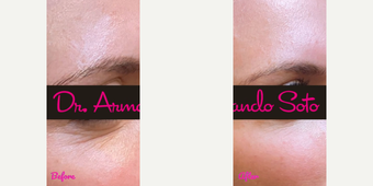 before and after image