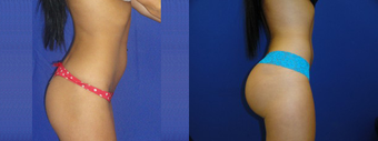 before and after image