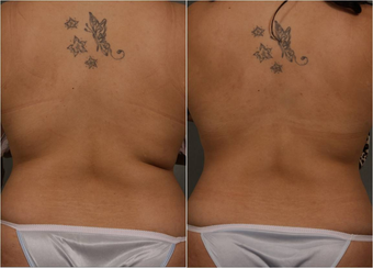 before and after image