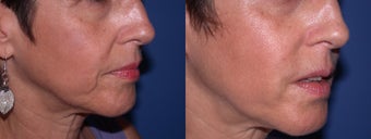 before and after image