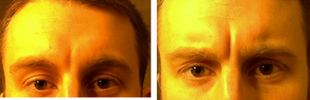 before and after image
