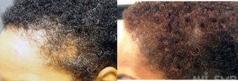 before and after image