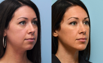before and after image