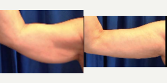 before and after image