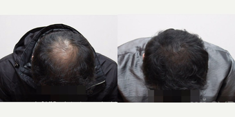 before and after image