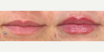 before and after image