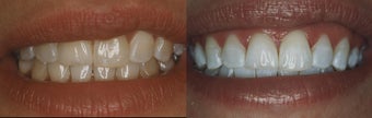before and after image
