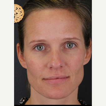 diamond glow near me