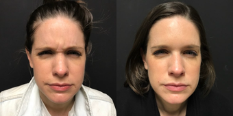 before and after image
