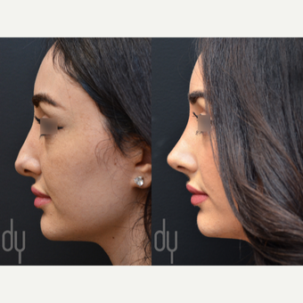 before and after image