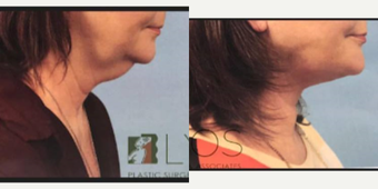 before and after image