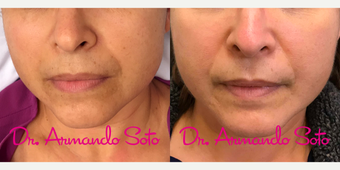 before and after image