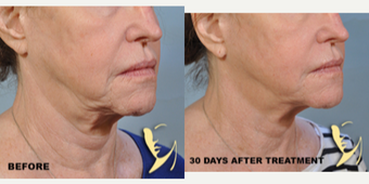 before and after image