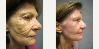 before and after image