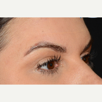 Microblading Before & After Pictures - RealSelf