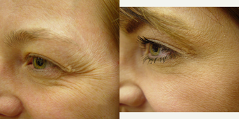 before and after image
