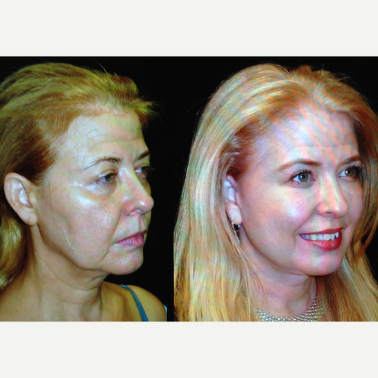 Soma Plastics Beverly Hills California Realself