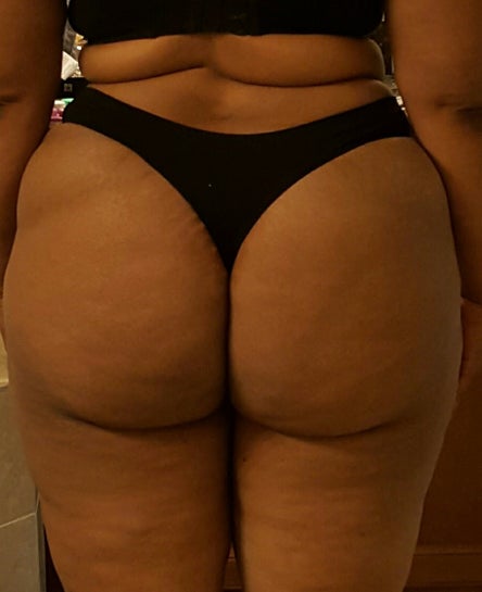 Will getting a BBL make my butt look fake because it is on the large side?  (Photos)