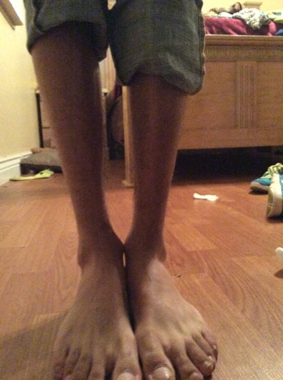I have really skinny legs (ankles) and I hate it. Is there