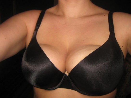 I have very wide set breasts, large areolas, and saggy breasts. What kind  of surgery would you recommend?