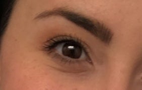 fine lines under eyes at 22