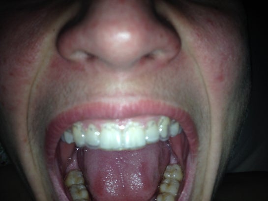 46+ Haven t worn my retainer in 5 years ideas in 2021 