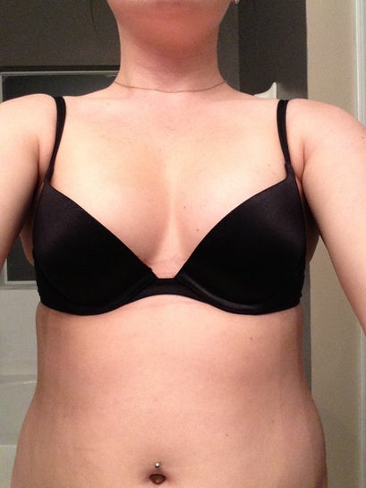 36A/32B to 400cc, Worry About Sizing? (photo)