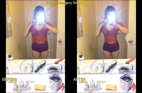 Is A Bbl The Best Possible Way To Get A Tiny Waist Photos