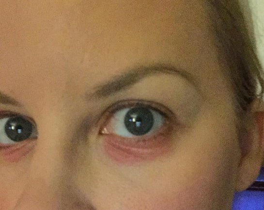 most effective retinol