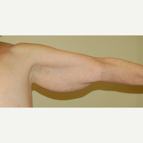 Tarrant Plastic Surgery Fort Worth Fort Worth Texas Realself