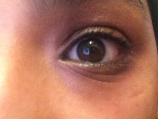 wrinkles under my eyes