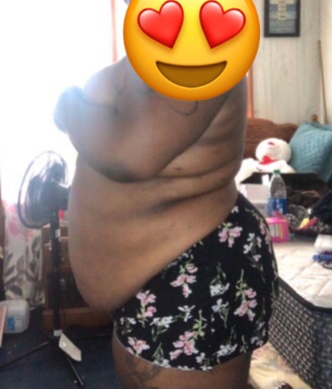 Can I get a BBL? I am a plus size girl and I'm content at the weight I'm at  now (Photo)
