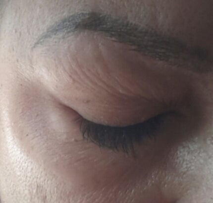 under eyelid wrinkles