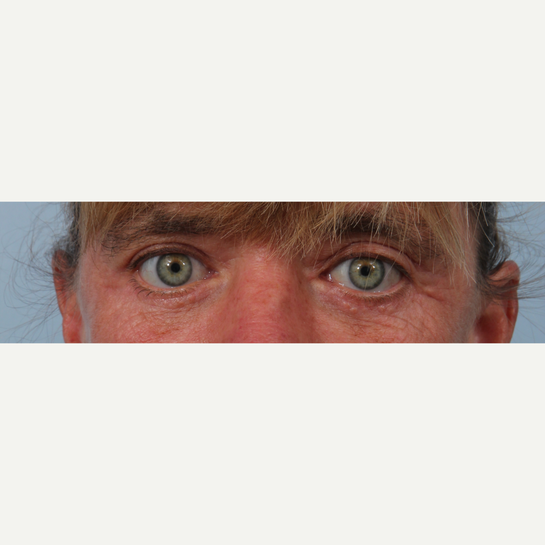 Williams Center Plastic Surgery Specialists Latham Latham New York Realself