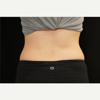Laseraway Novato Novato California Realself San francisco's laseraway offers a wide range of cosmetic procedures to enhance your beauty. laseraway novato novato california