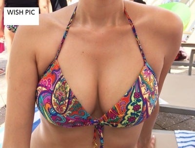 Can I get youthful, perky breast of 36D? I don't want any implants