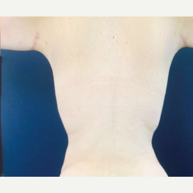 Premium Care Plastic Surgery Cartagena Bolivar Realself