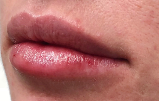 behr laser & skin care center