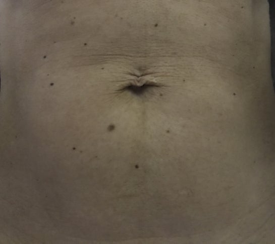Loose belly button piercing top