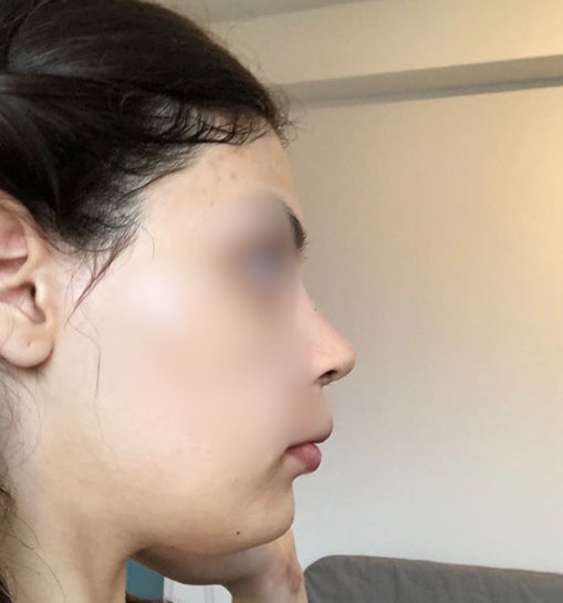 I hate the shape of my face (long) Is there something not too invasive i  could do to improve it? : r/beauty