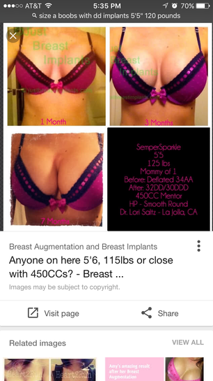 I am 17 ,5'4, 44DDD, 194lbs. Am i a good candidate for breast