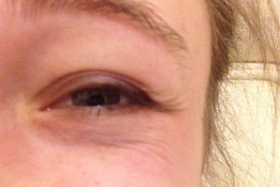 crows feet young age